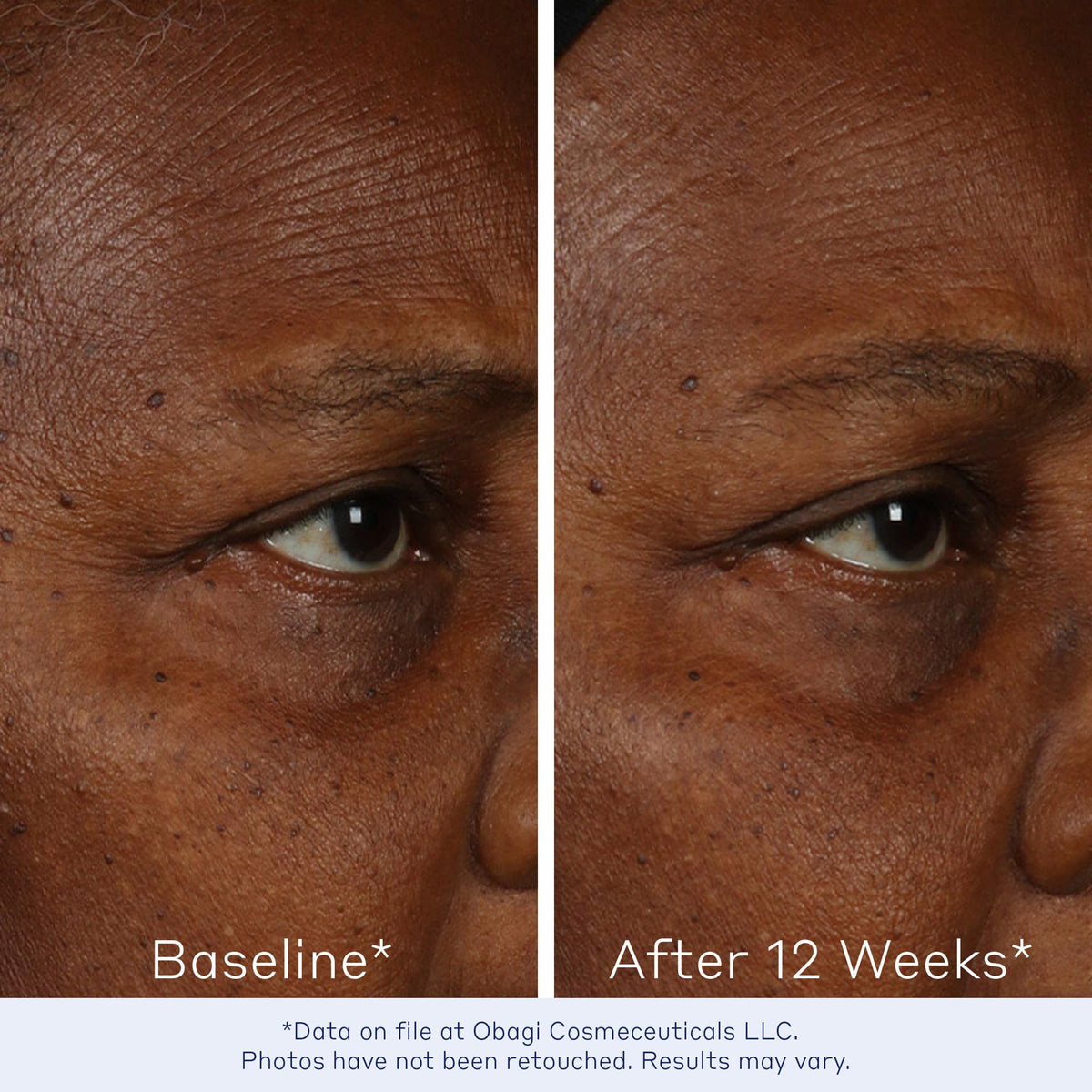 Obagi ELASTIderm label and ingredients panel highlighting the Bi-Mineral Contour Complex