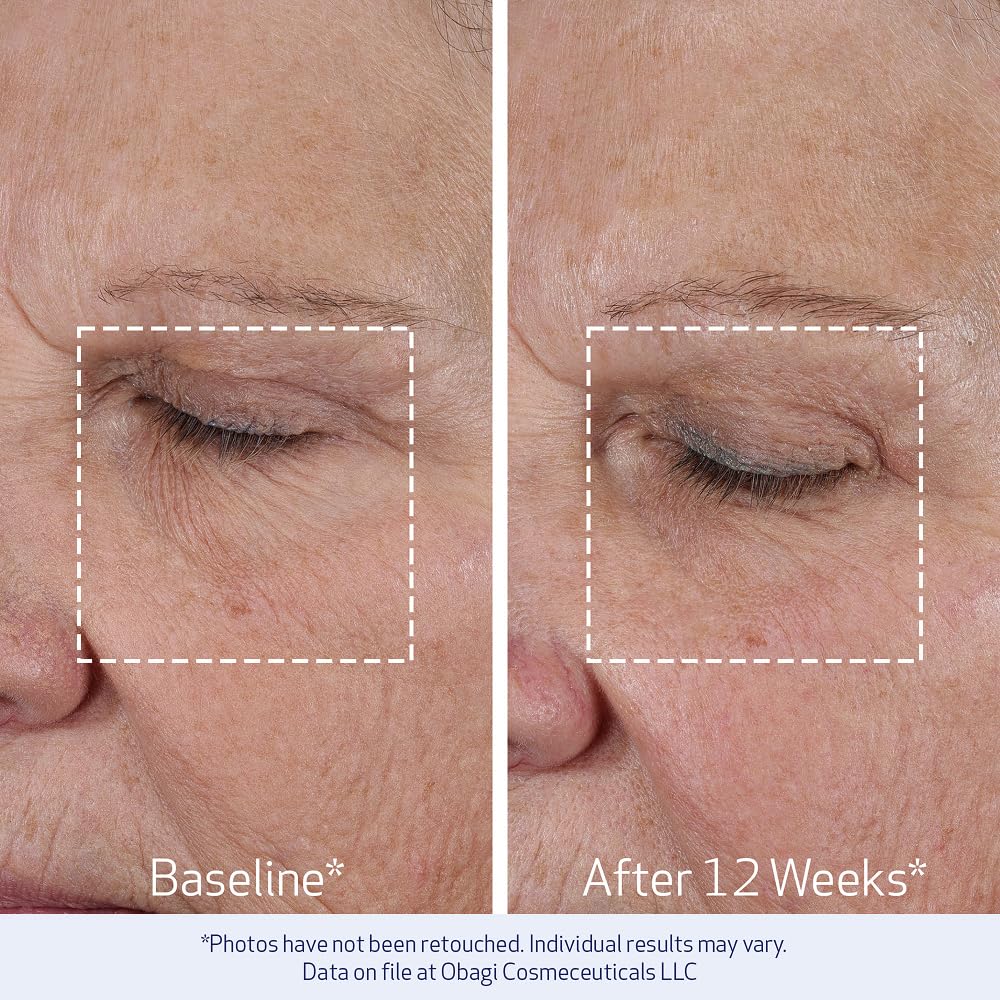 Obagi ELASTIderm beside a ruler showing 1.7 oz size for travel-friendly skincare