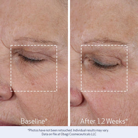 Obagi ELASTIderm beside a ruler showing 1.7 oz size for travel-friendly skincare