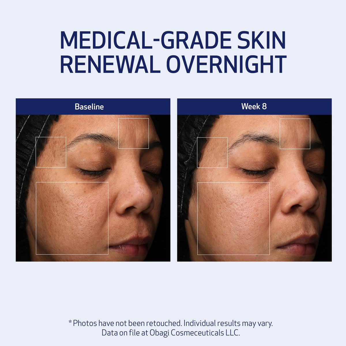 Obagi Medical applied in a nighttime routine for skin renewal