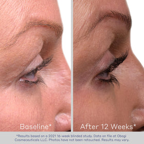 Obagi Nu-Cil before and after comparison suggesting thicker lashes