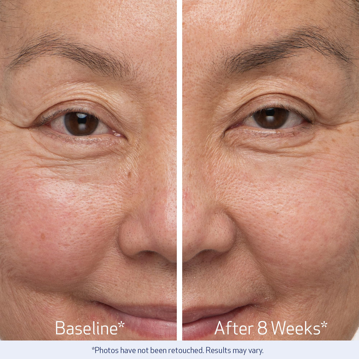 Obagi Nu-Cil dual set layout showing both serums for a complete lash and brow routine