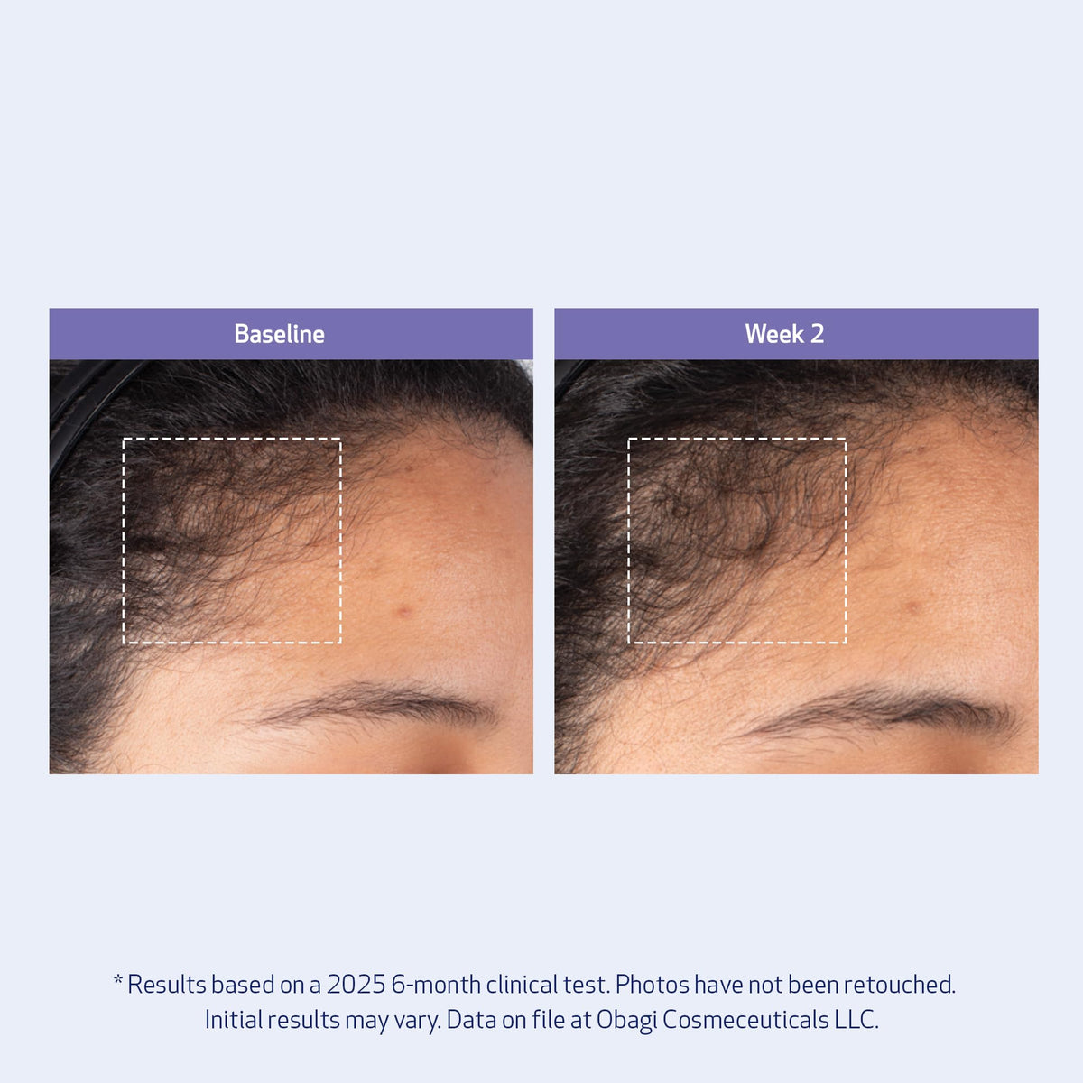 Obagi Medical ingredients label close-up emphasizing BioStim Complex and biotin