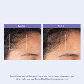 Obagi Medical ingredients label close-up emphasizing BioStim Complex and biotin