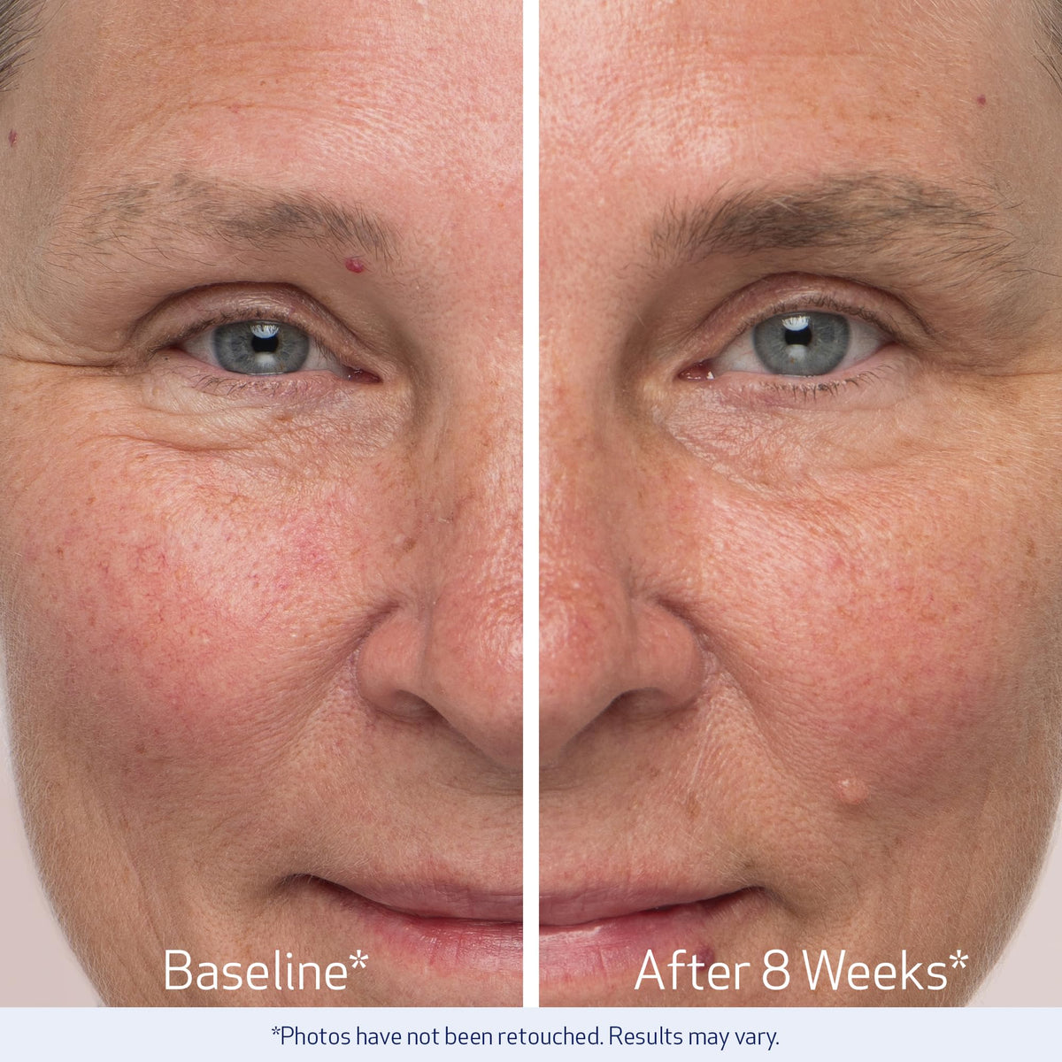 Obagi Nu-Cil model applying serum to brows demonstrating targeted application benefit