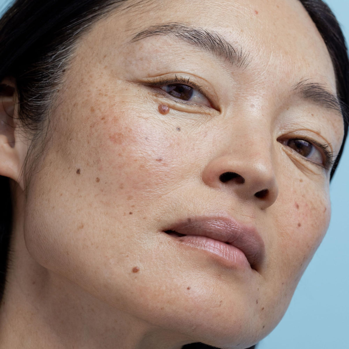 Obagi Medical Nu-Derm Exfoderm Forte before and after texture comparison illustrating smoother, refined skin appearance