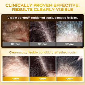 oely close-up of active ingredient panel highlighting antifungal actives and calming properties