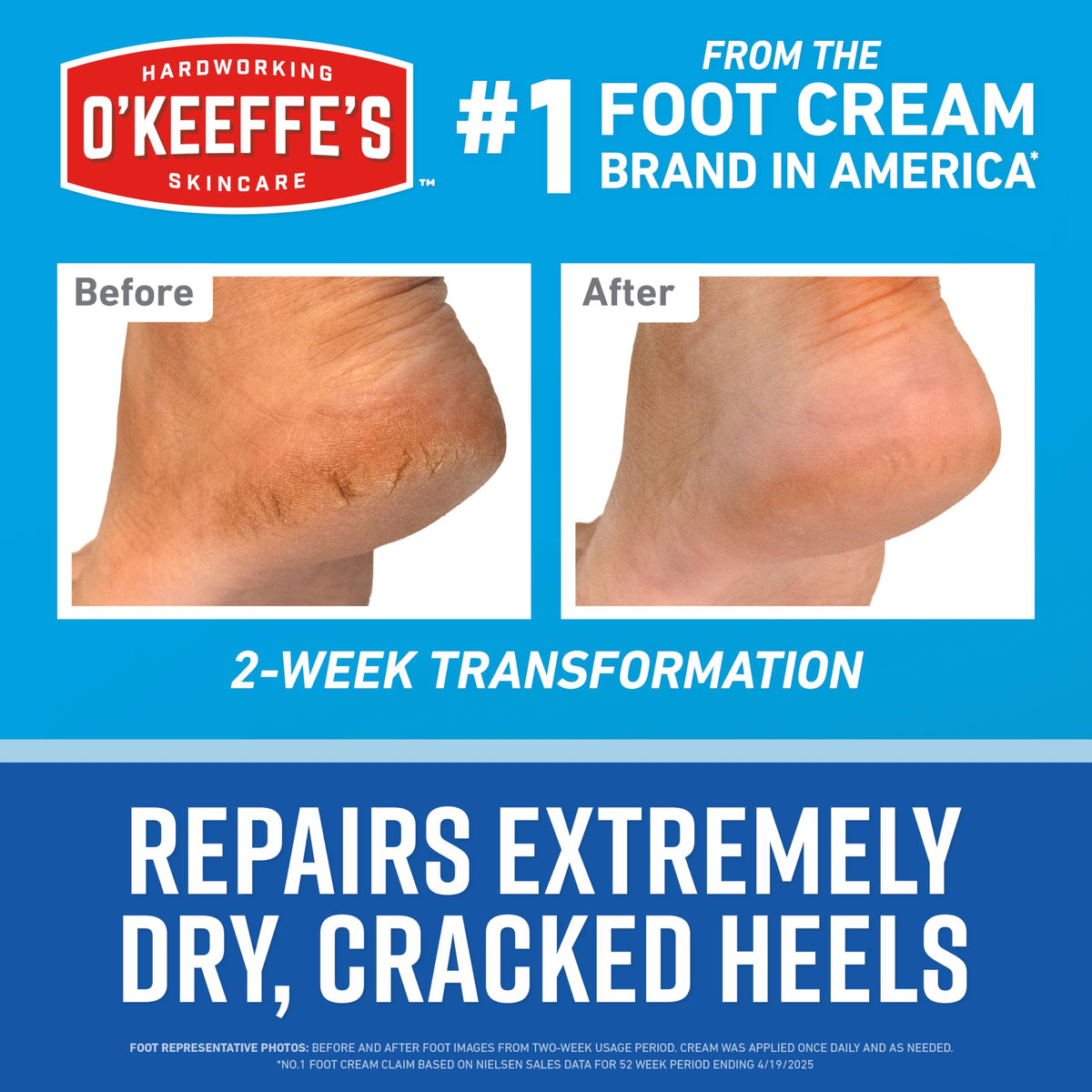 O'Keeffe's cream applied to heel demonstrating targeted hydration