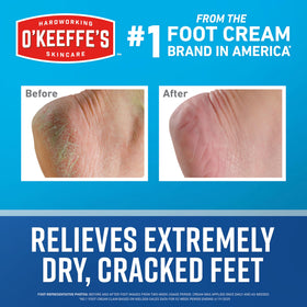 O'Keeffe's being applied to heel demonstrating targeted repair and immediate hydration