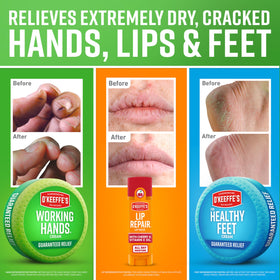 O'Keeffe's Healthy Feet jar top view highlighting product size and lid