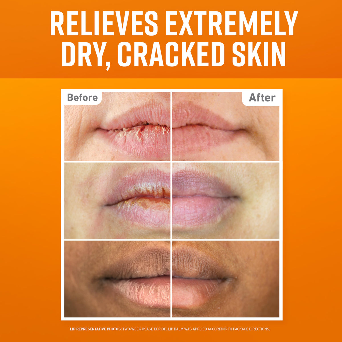 O'Keeffe's three lip repair sticks lined up for variety and convenience
