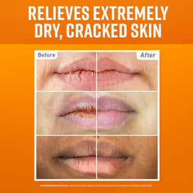 O'Keeffe's three lip repair sticks lined up for variety and convenience