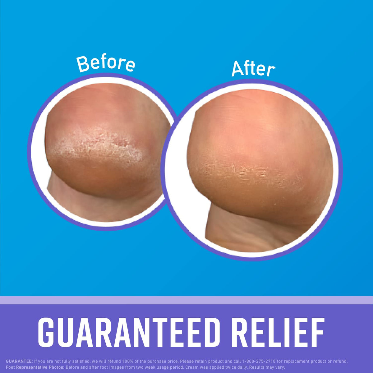 O'Keeffe's cream texture close-up for Healthy Feet showing thicker conditioning