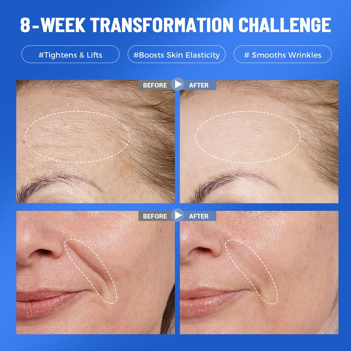 Okela hydrogel mask adhered to face delivering cooling comfort and lift
