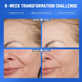 Okela hydrogel mask adhered to face delivering cooling comfort and lift