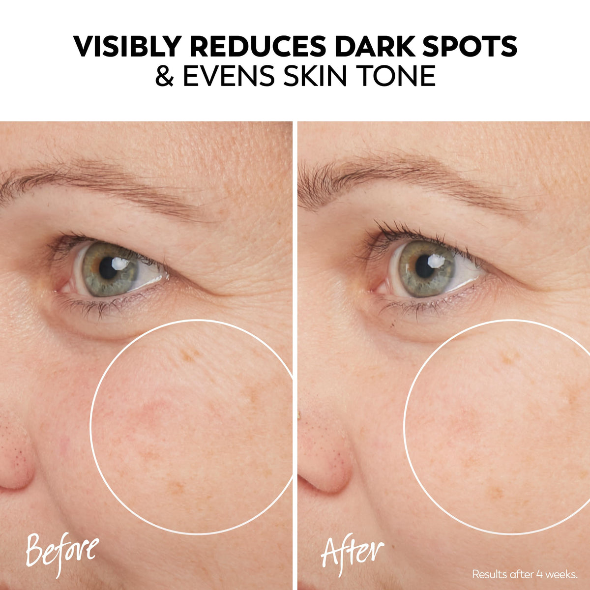 Olay phlorogine marine extract ingredient depiction reducing dark spots