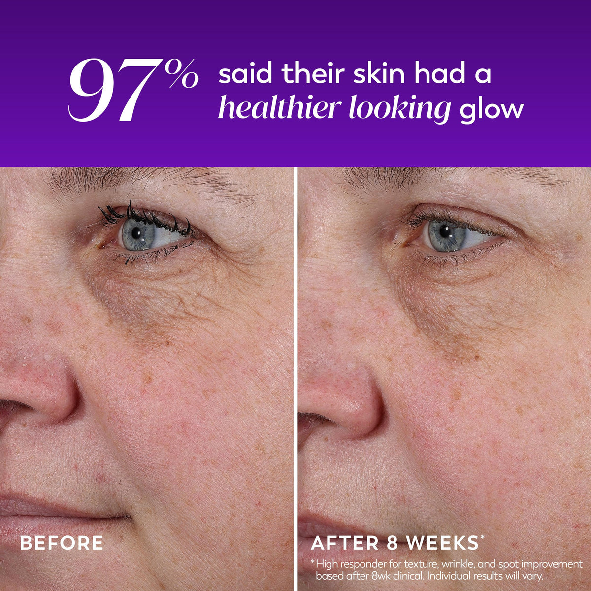 Olay application at night on fingertip demonstrating easy nightly use