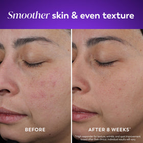 Close-up of Olay retinol cream texture emphasizing quick-absorbing finish