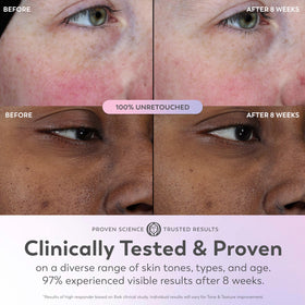 Olay applying serum on face to show smooth application and instant glow