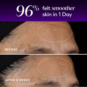 Olay texture close-up illustrating lightweight serum finish and fast absorption benefit