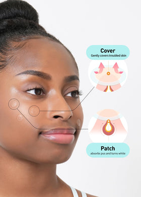 OLIVE YOUNG single patch applied to cheek demonstrating adhesion and invisibility