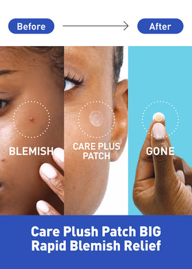OLIVE YOUNG close-up of hydrocolloid texture for effective absorption