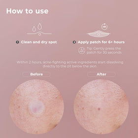 OMMA patch in bedside skincare scene, supports overnight spot treatment routine