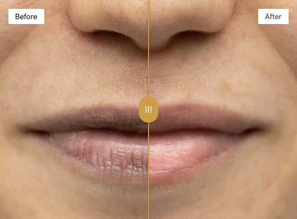 OMORFEE application demo on lips demonstrating gentle circular massage