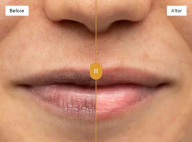 OMORFEE application demo on lips demonstrating gentle circular massage
