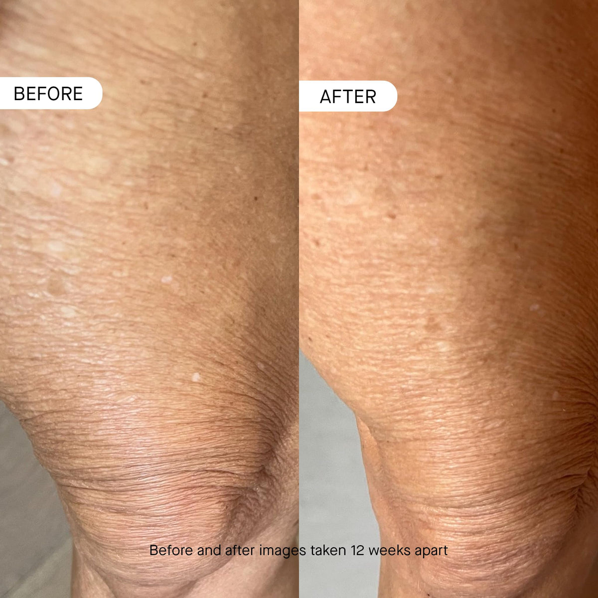 oneskin texture close-up of lotion spread, demonstrates lightweight absorption and hydration