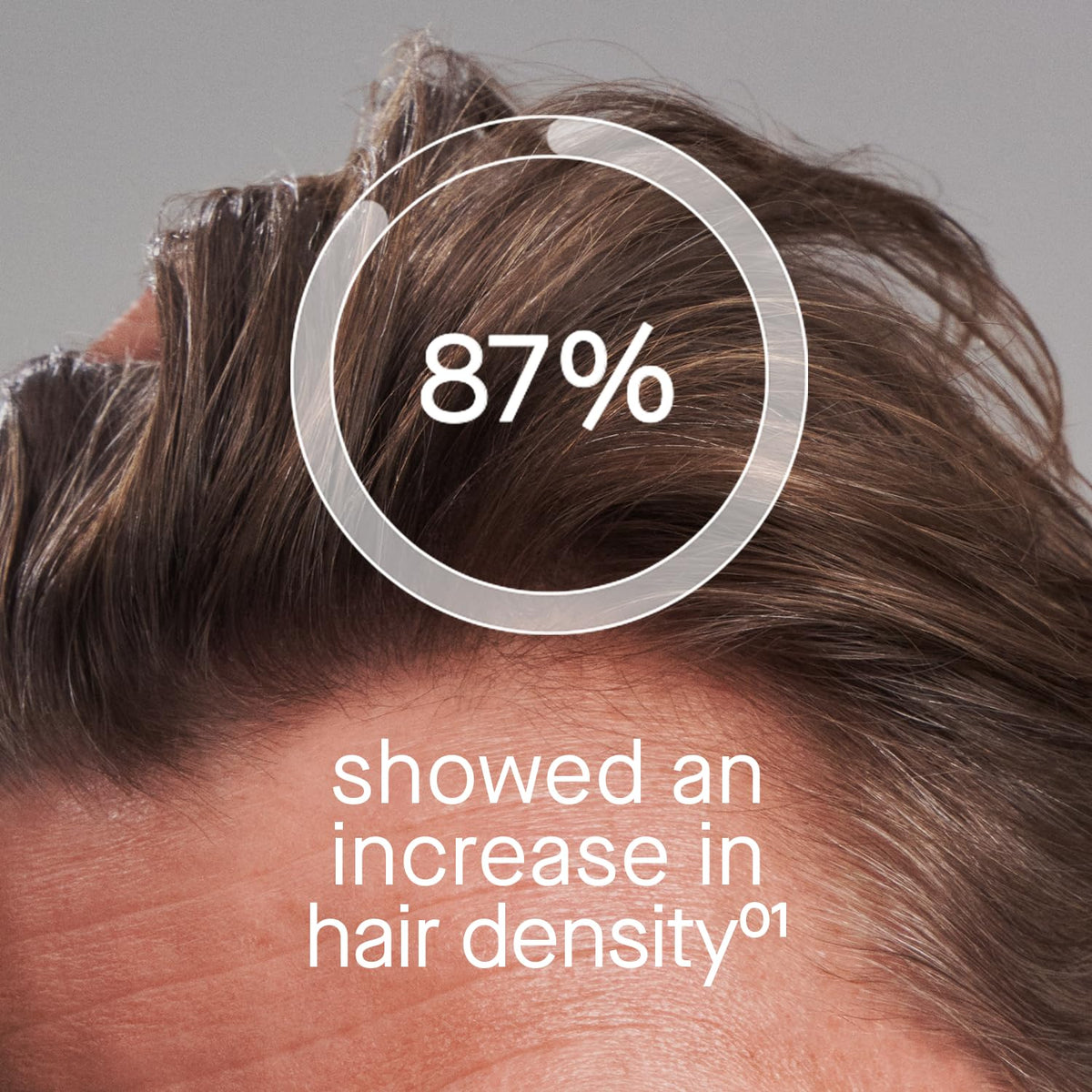 oneskin OS-01 applied to scalp highlighting targeted use