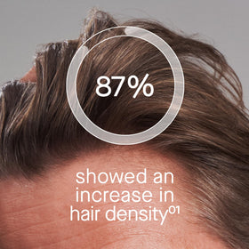 oneskin OS-01 applied to scalp highlighting targeted use
