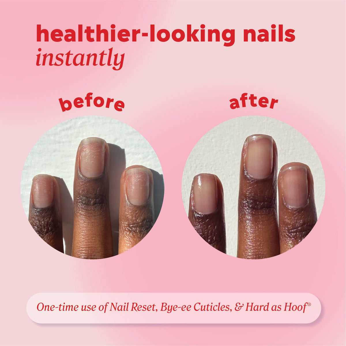 Onyx Professional cream being applied to fingernails showing improved hydration benefit