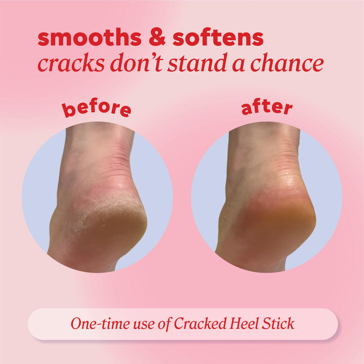 Onyx Professional being applied to a heel for targeted hydration