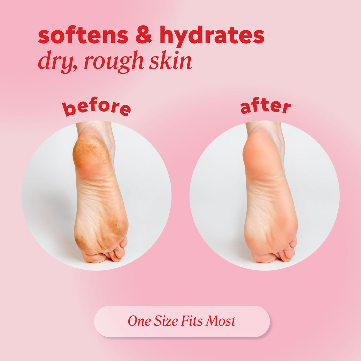 Onyx Professional socks on feet during treatment for rapid hydration