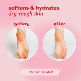 Onyx Professional socks on feet during treatment for rapid hydration