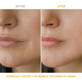 #OOTD cream applied to face and neck demonstrating hydration benefits