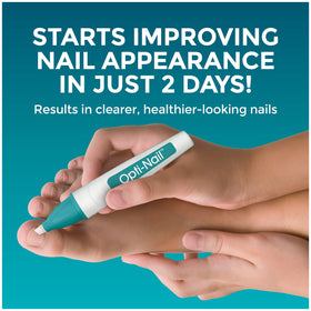 Opti-Nail before and after nail photo showing improved appearance