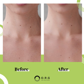 O.R.G. open jar revealing creamy gel to demonstrate product consistency