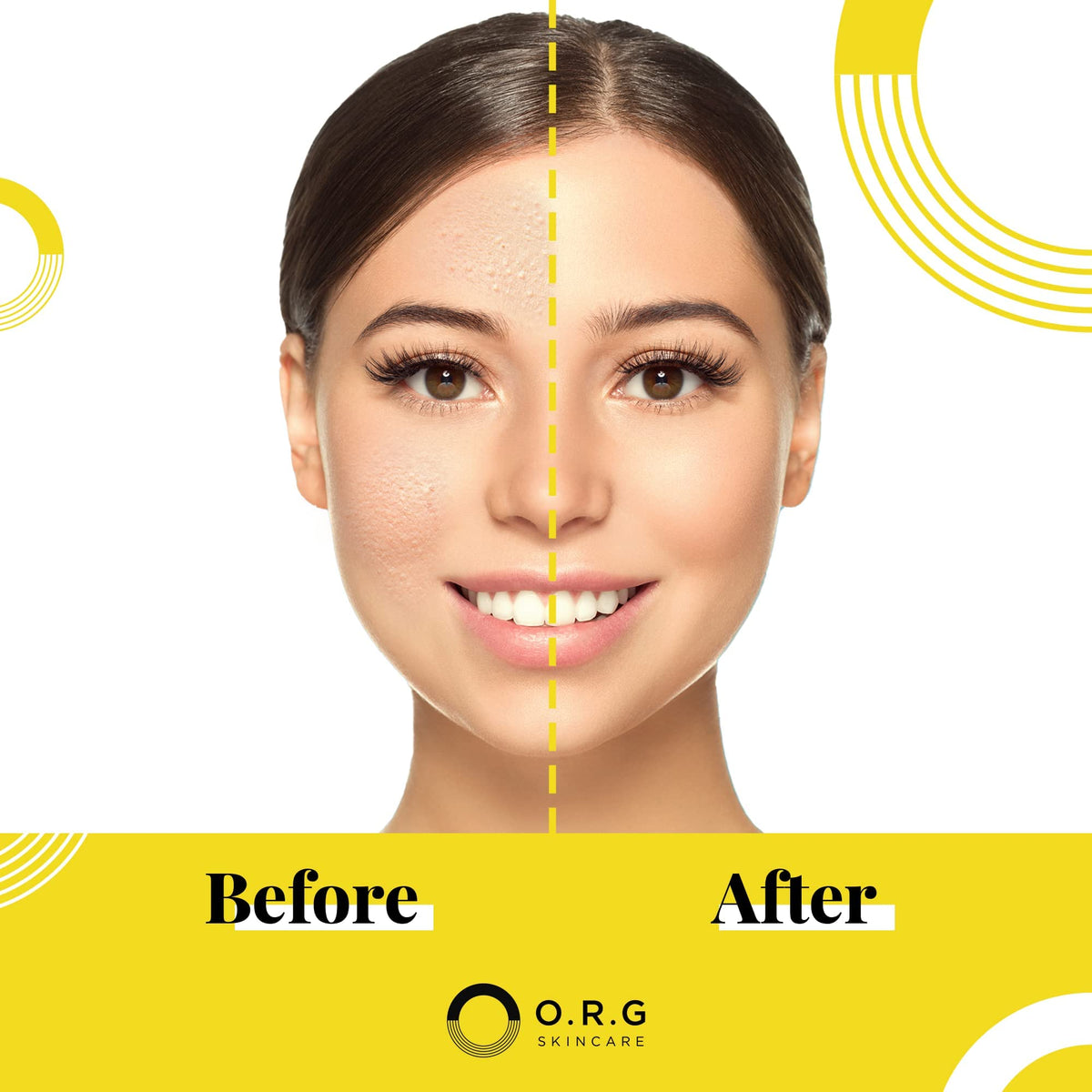 O.R.G. mask application on model demonstrating easy spread and removal