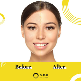 O.R.G. mask application on model demonstrating easy spread and removal