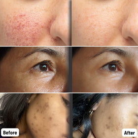 ORGAID mask staged in bathroom routine illustrating daily skincare boost