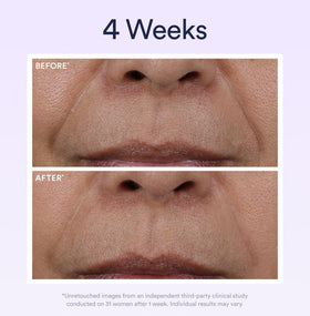 OSEA before and after skin close-up showing smoother, firmer appearance benefit