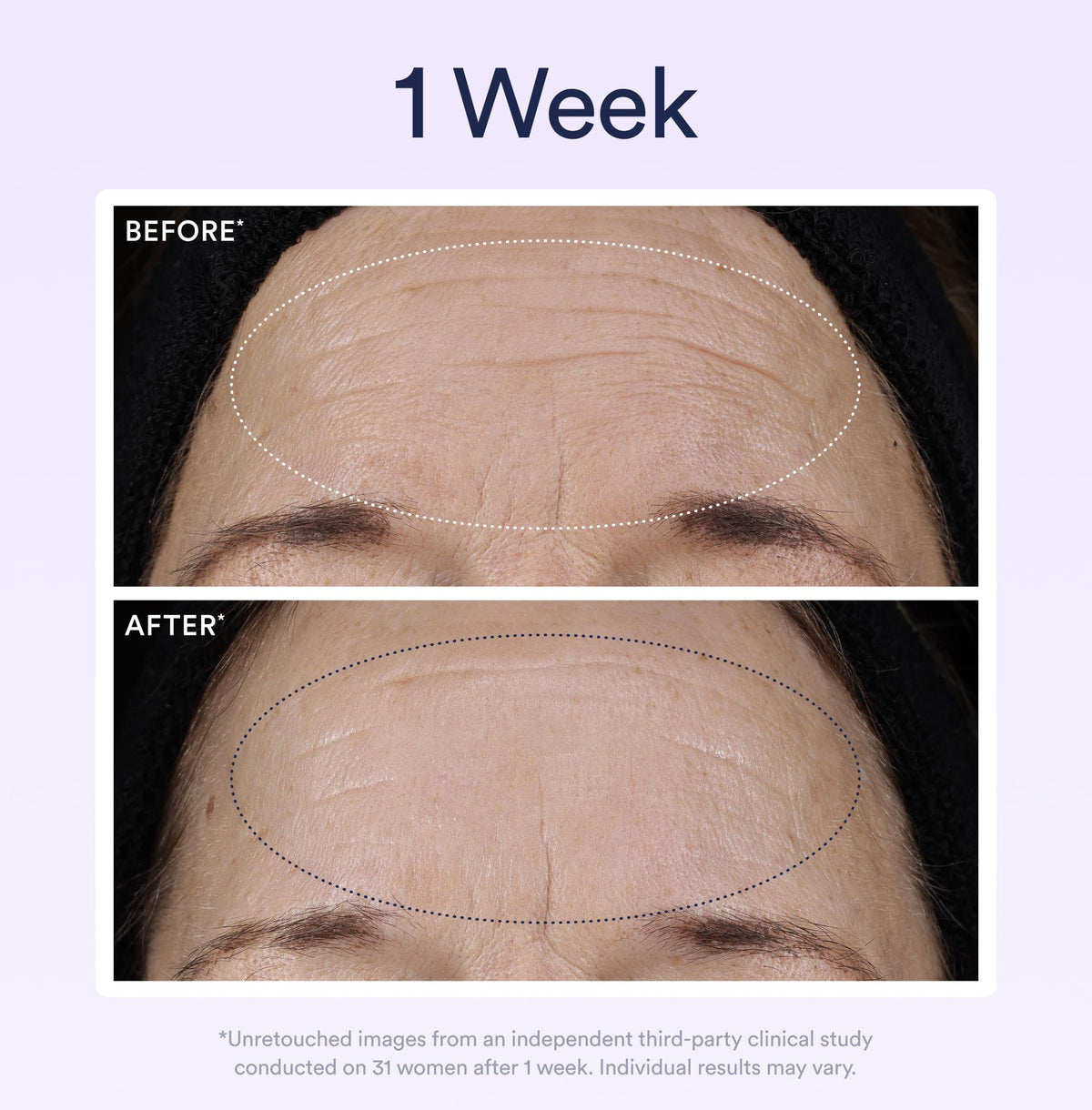 OSEA algae ingredient visual linking plant-based bio-retinol benefits