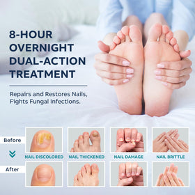 OSIMOON sheet of nighttime patches protecting nails during sleep