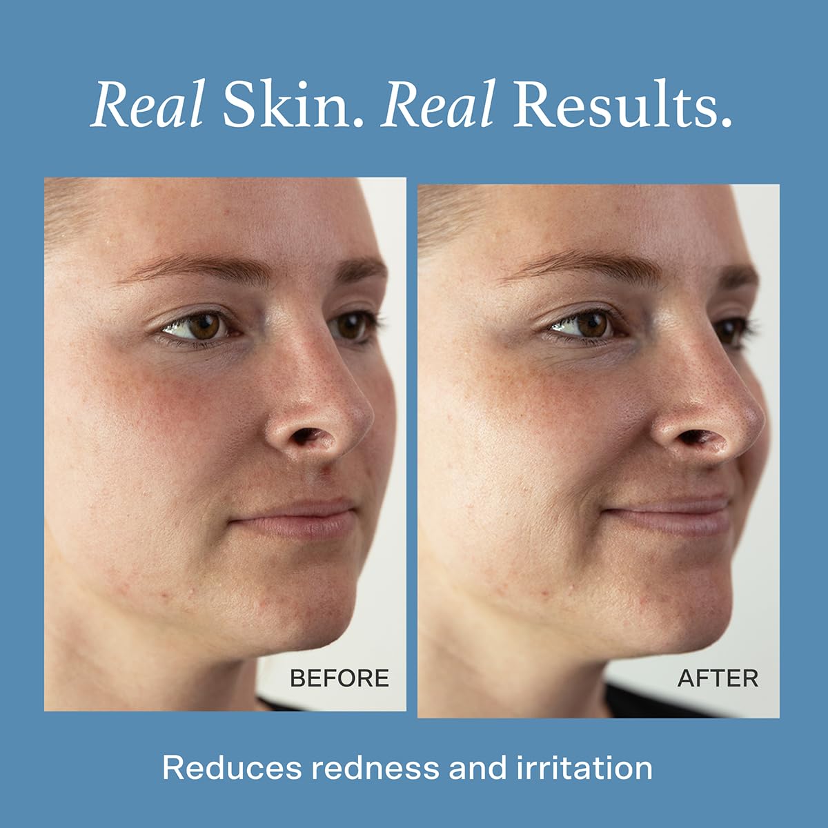 Otella mist spraying fine particles for quick cooling and refresh benefit