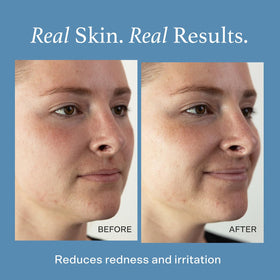 Otella mist spraying fine particles for quick cooling and refresh benefit