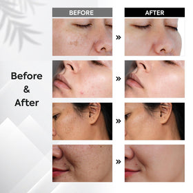 Oudetas serum texture on skin showing lightweight, non-greasy hydration