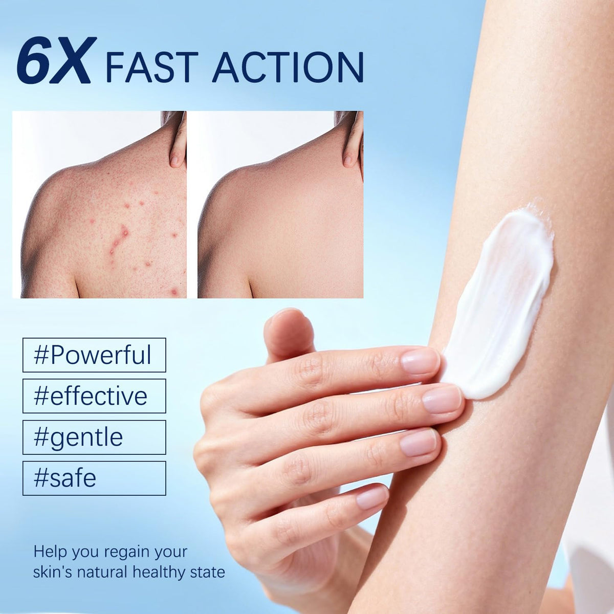 OUHENGTEK application on scalp demonstration calming irritated follicles