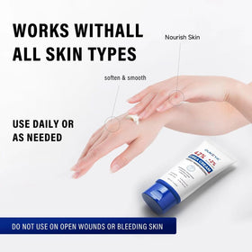 OUKEYA cream applied to heel demonstrating softening benefit